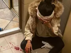 PILNE! Była tancerka uwielbianego zespołu disco polo brutalnie pobita! Dramatyczne sceny rozegrały się pod jej domem!