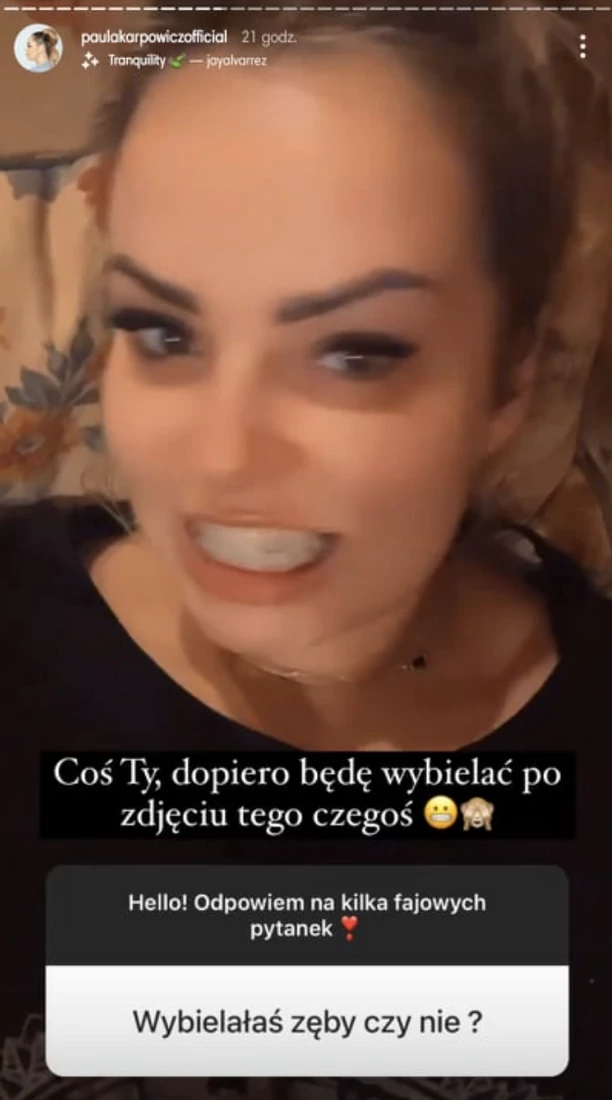 Paula Karpowicz Topky zdecydowała się poprawić swoją urodę! Gwiazda zmaga się teraz  z bólem, który utrudnia jej życie! 