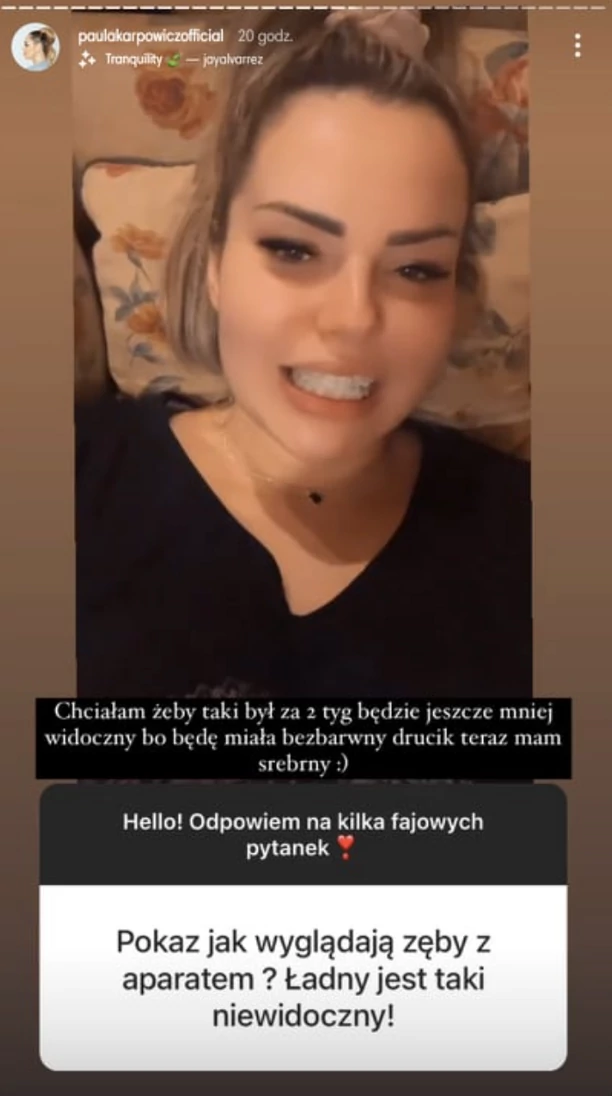 Paula Karpowicz Topky zdecydowała się poprawić swoją urodę! Gwiazda zmaga się teraz  z bólem, który utrudnia jej życie! 