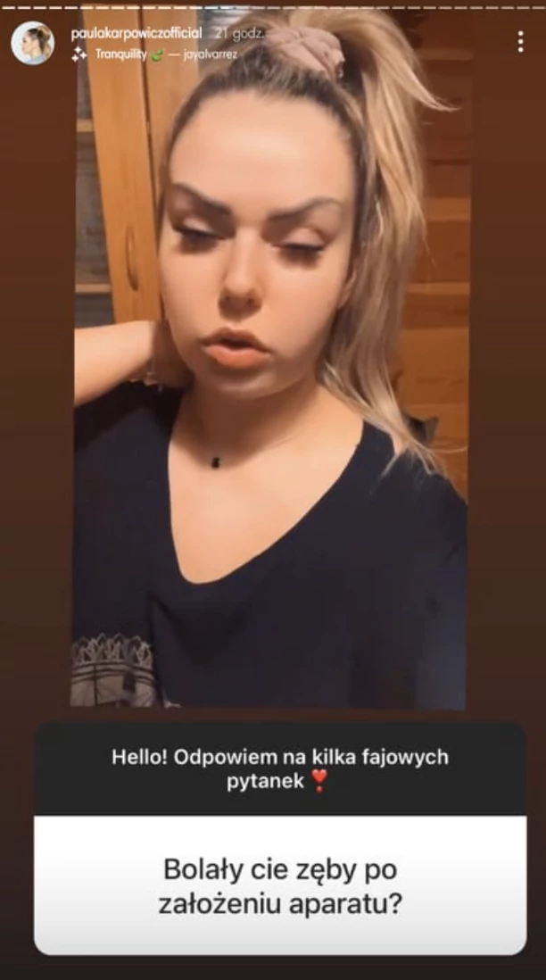 Paula Karpowicz Topky zdecydowała się poprawić swoją urodę! Gwiazda zmaga się teraz  z bólem, który utrudnia jej życie! 