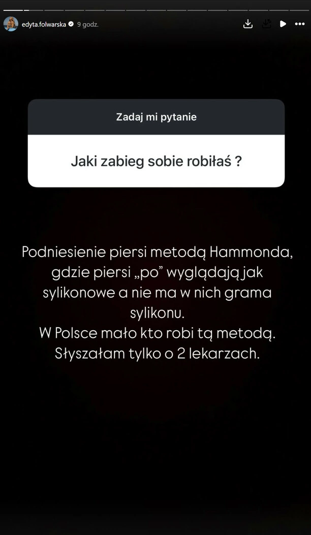 Edyta Folwarska powiększyła piersi?! Jest już po operacji wiemy jak się czuje i znamy cenę zabiegu! 