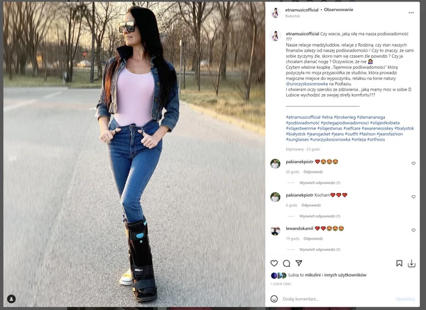 Znana wokalistka dochodzi do siebie po operacji! Internauci zachwyceni wizerunkiem Etny! FOTO