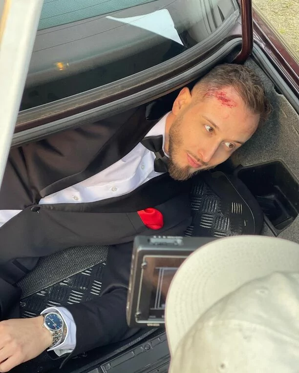 Zakrwawiony wokalista disco polo z urazem głowy. Dramatyczny obrazek wyciekł do sieci.
