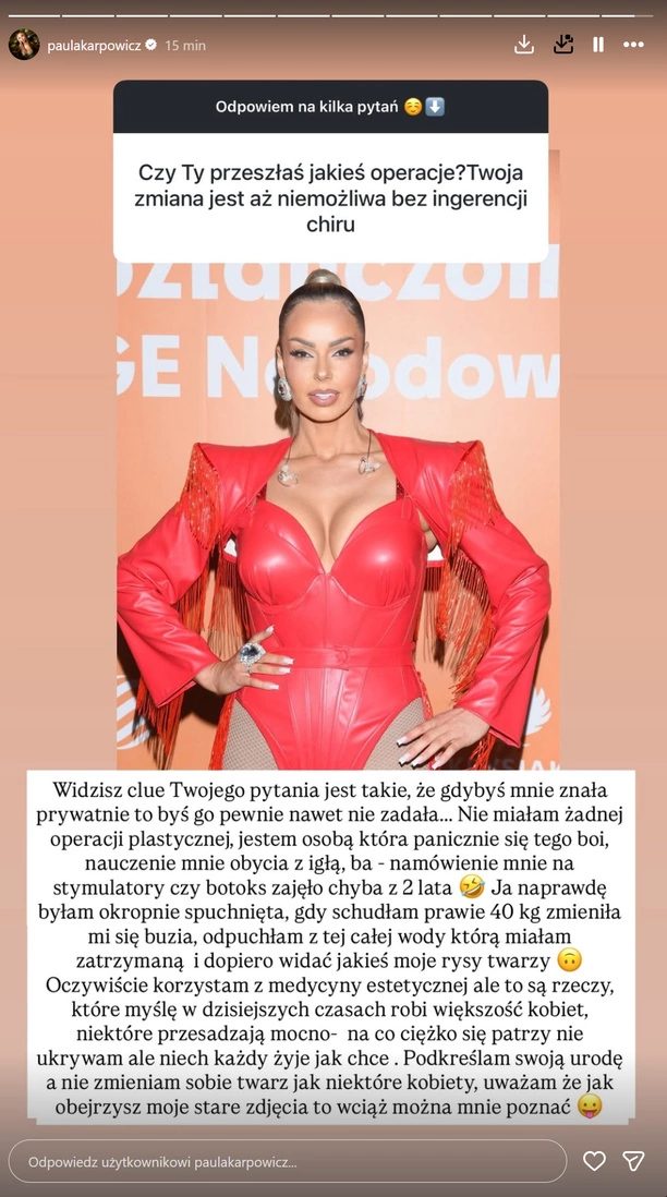 Paula Karpowicz-Zimecka z Topky przerwała milczenie. Wyjawiła prawdę o operacjach plastycznych