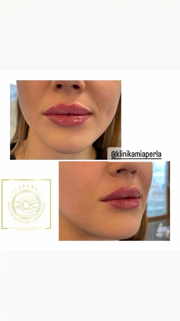 Narzeczona Daniela Martyniuka, Faustyna powiększyła sobie usta?!  Wygląda obłędnie! Zobaczcie zdjęcie