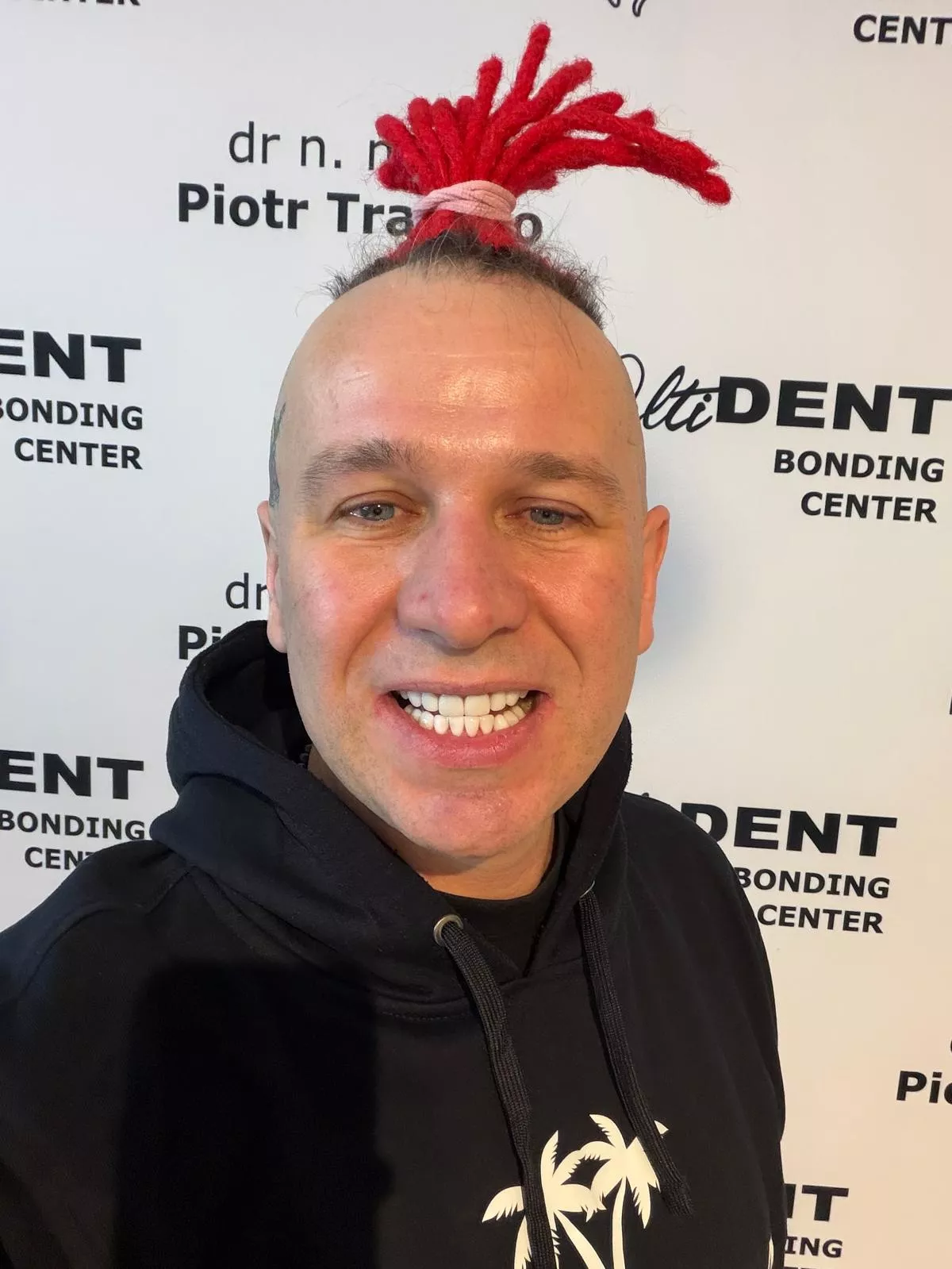 Bezczelny skok na uśmiech za 30 tysięcy. Dentysta Luxona i Dawida Narożnego Dr. Trafidło oszukany!