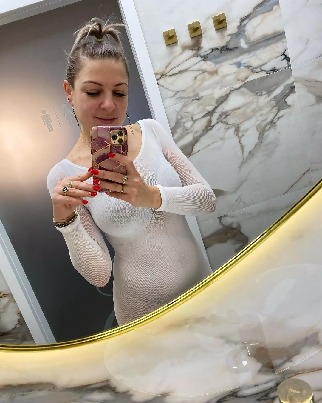 Magdalena Narożna - Piękni i Młodzi przyłapana w znanej klinice! Gwiazda disco polo poddała się skomplikowanemu zabiegowi?! 