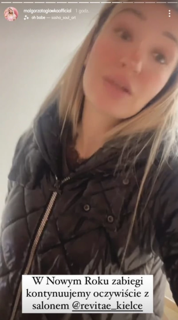 Gosia Camasutra zdradziła swój sposób na piękną i zdrową skórę! Artystka disco polo wygląda rewelacyjnie! 