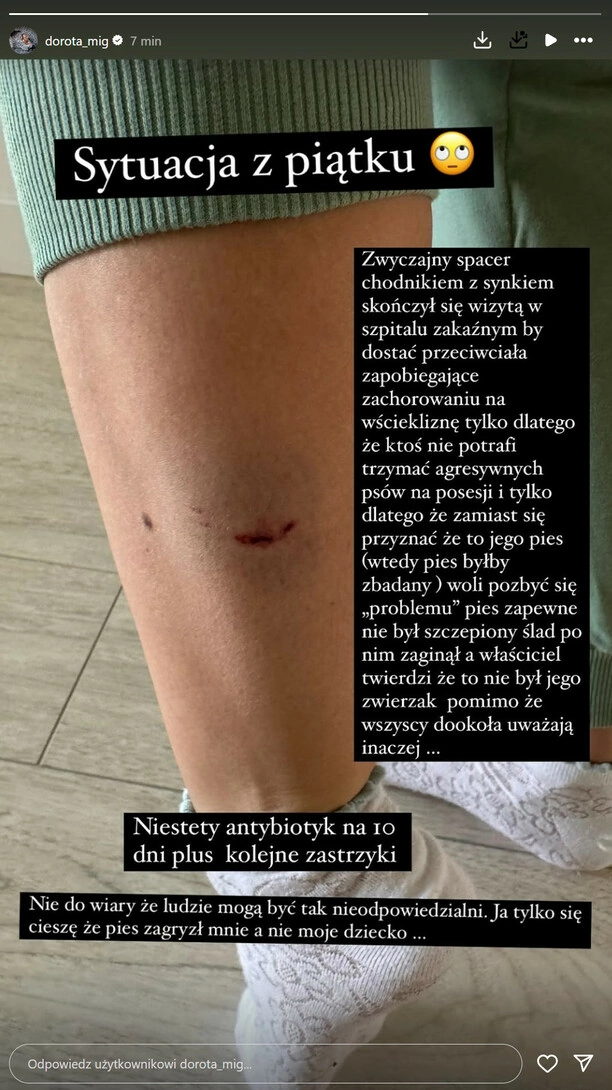 Szok! Dorota z zespołu MIG pogryziona przez psa! Trafiła do szpitala! 