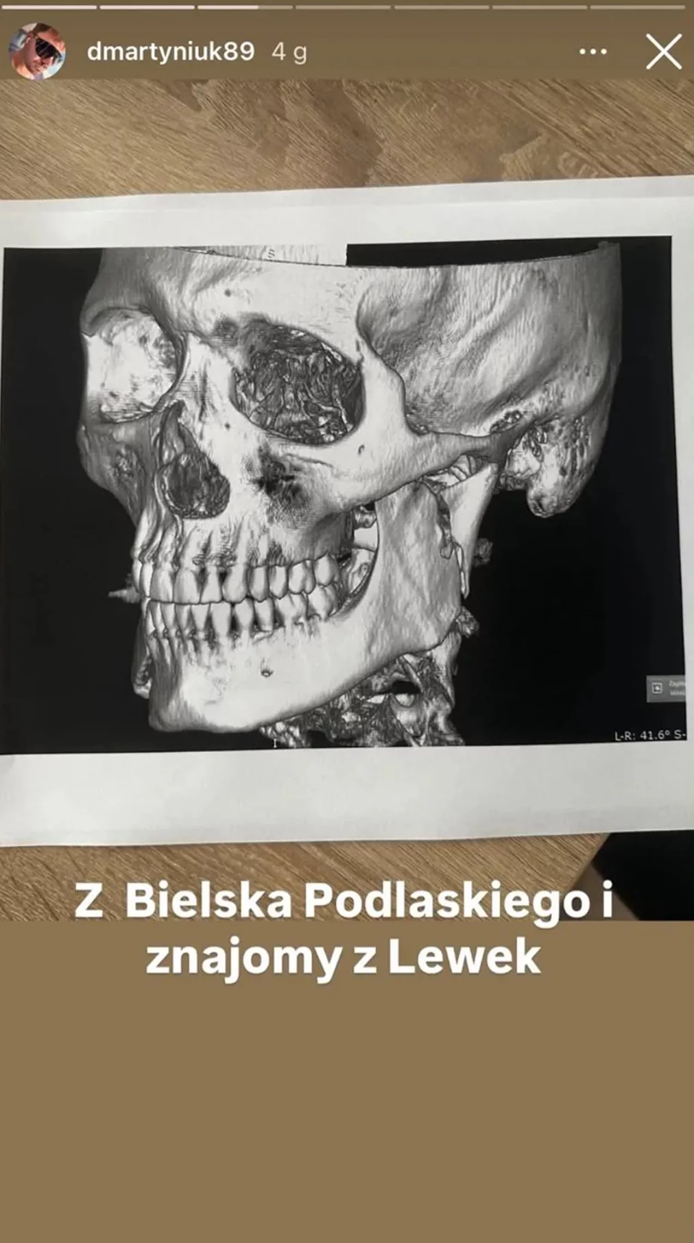 Daniel Martyniuk pobity? Syn Zenka Martyniuka oskarża rodzinę „Nie wybaczę wam tego"