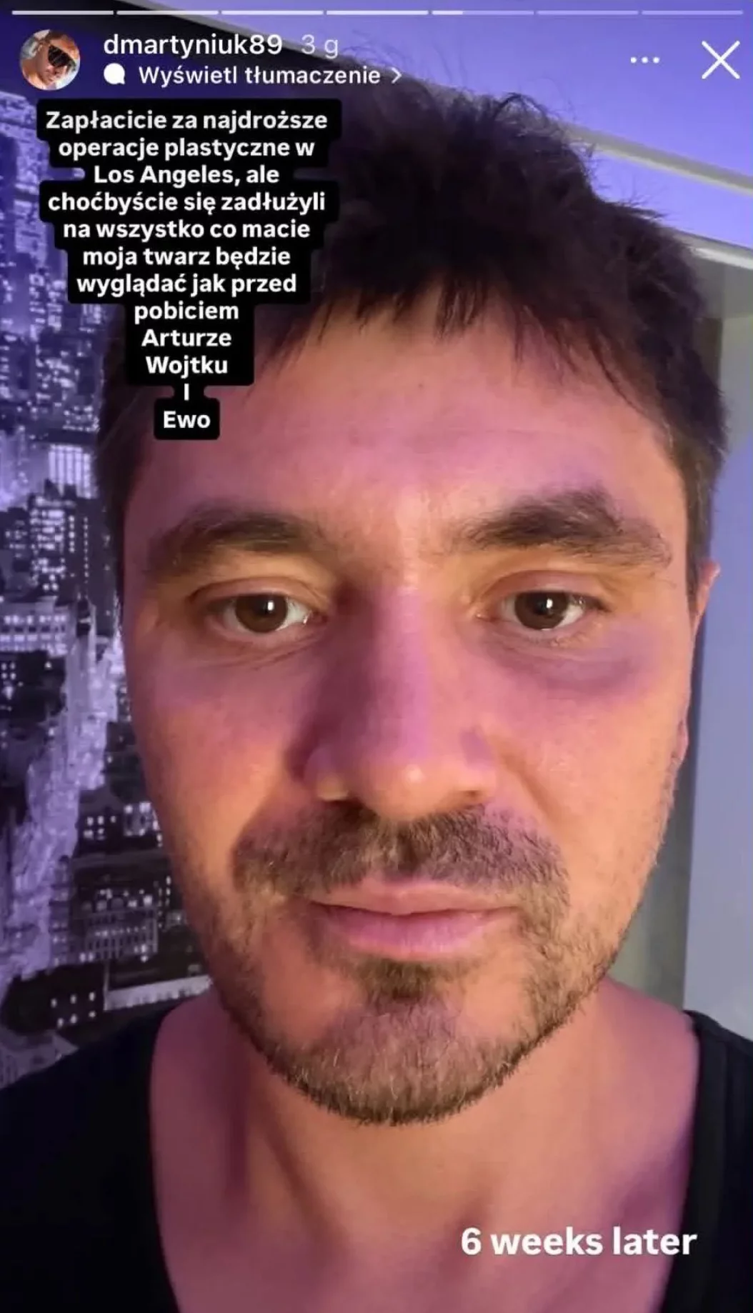 Daniel Martyniuk pobity? Syn Zenka Martyniuka oskarża rodzinę „Nie wybaczę wam tego"