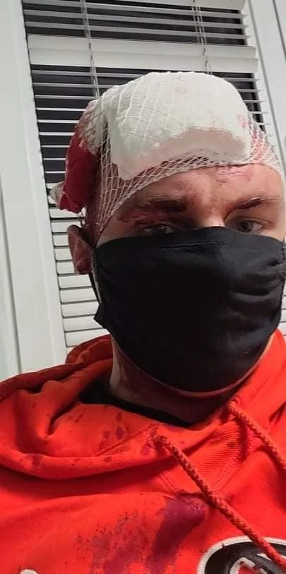 Przemysław Gilewicz - pobicie