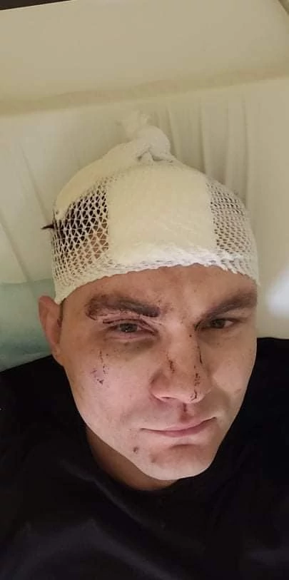 Wokalista disco polo czeka na operacje