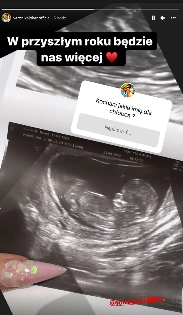Łzy radości podczas USG! To już oficjalnie - Piotr Koczocik Joker zostanie ojcem! Jego reakcja jest niesamowita! 