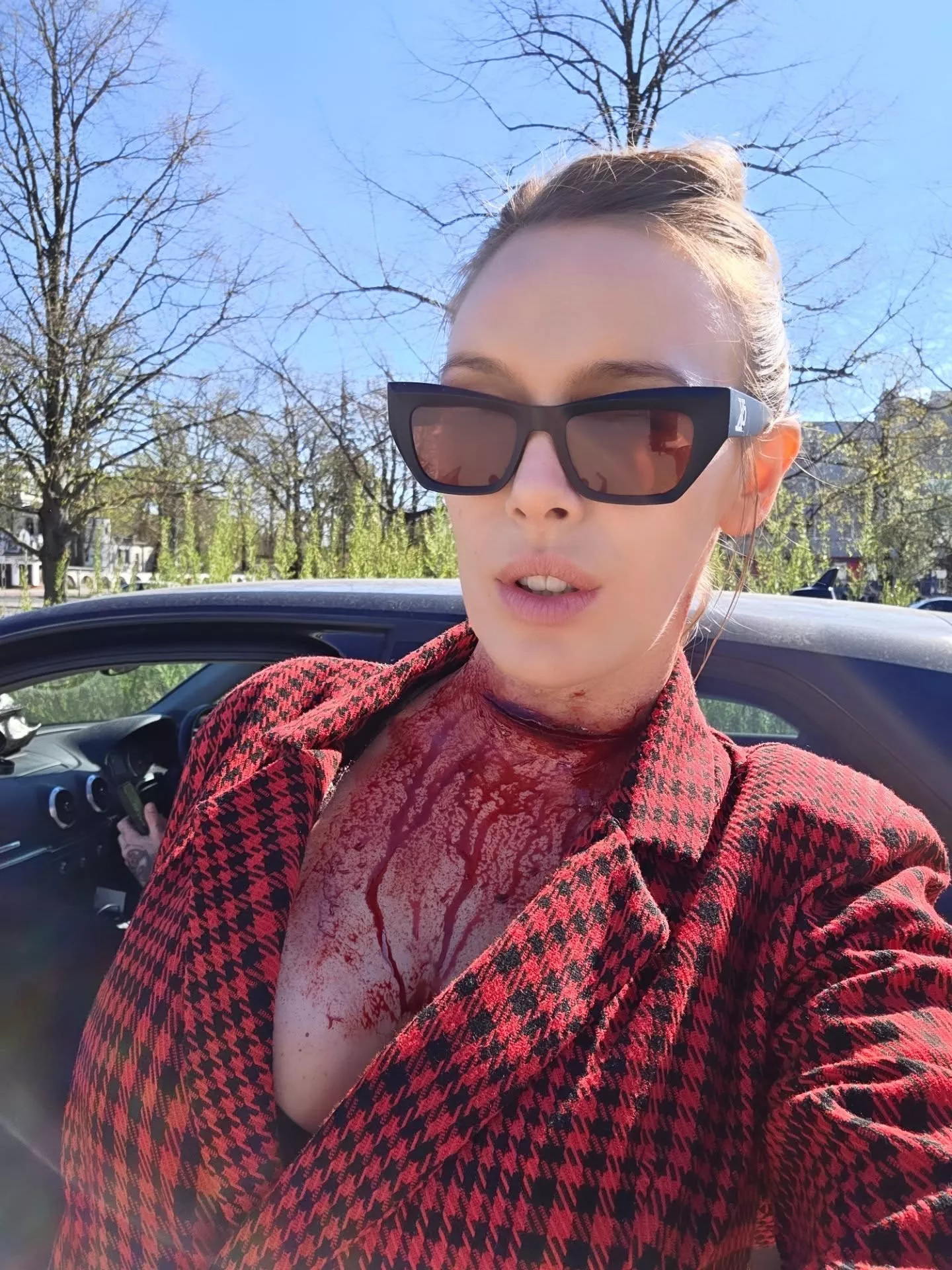 Nikola Raczko z Top Girls cała we krwi! Co się stało z gwiazdą disco polo?