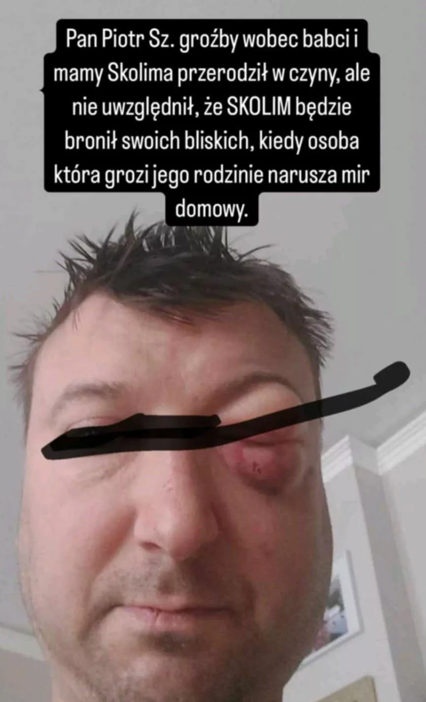 PILNE! Skolim brutalnie zaatakowany we własnym domu! Gwiazdor i jego rodzina przeżyli chwile grozy