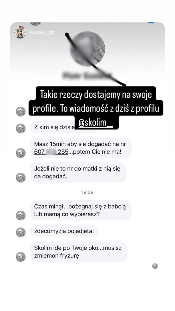PILNE! Skolim brutalnie zaatakowany we własnym domu! Gwiazdor i jego rodzina przeżyli chwile grozy