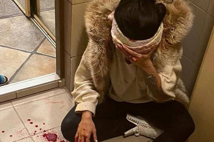 Dramatyczne sceny pobicia...Krew tancerki disco polo była niemal wszędzie.