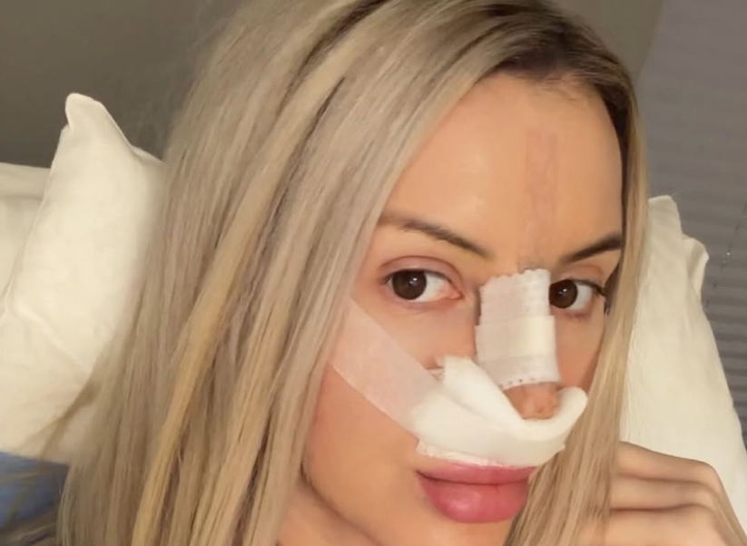 Maluba poddała się operacji nosa. Wokalistka disco polo wyjaśniła swoją decyzję