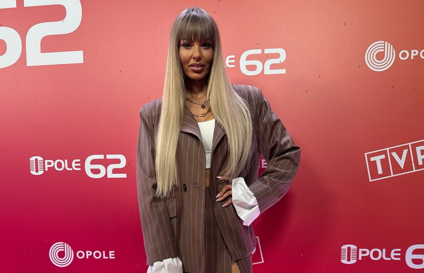 Paula Karpowicz-Zimecka z Topky przerwała milczenie. Wyjawiła prawdę o operacjach plastycznych