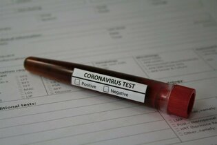 PILNE! Artysta disco polo zarażony koronawirusem?! Ma 40 stopni gorączki!