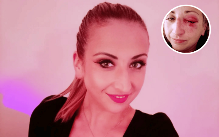 Tragiczny wypadek gwiazdy Disco Polo: Skorusa postrzelona